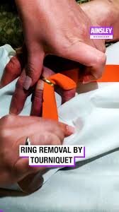 Image result for Ring Removal