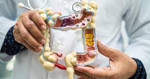 What Is Gut Health? | Tips to Improve Your Gut Health