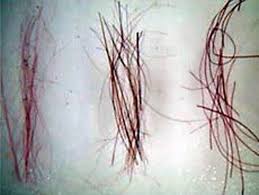 Hair Three Types Prepared Microscope Slide