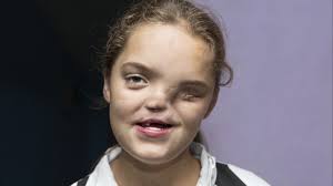 Die ukraine gedenkt morgen der opfer der verheerenden explosion im damals noch sowjetischen atomkraftwerk tschernobyl am 26. Einblick In Die Einrichtungen Fur Die Vergessenen Tschernobyl Opfer