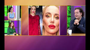Gulsen In Yuzu Estetik Faciasina Donustu Muge Ve Gulsen Le 2 Sayfa Youtube