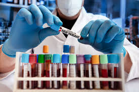Le variant indien ne peut cependant pas être incriminé à lui seul pour la hausse spectaculaire de cas en inde, qui aurait baissé la garde trop tôt, selon soumya swaminathan. Variant Indien Comment Ses Mutations Changent Sa Biologie