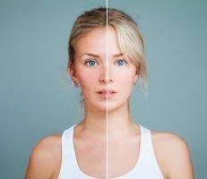 Mohs Surgery Specialist