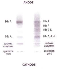 What size fragment you're looking for, how good you need the separation of fragments to be, and whether or not you will be gene cleaning gel slices after you electrophorese them. Electroforeza Hemoglobinei Synevo