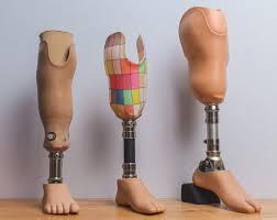 Prosthetics - J.P. Visser