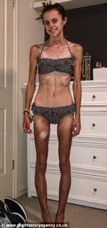 Check spelling or type a new query. Blogger Documents Her Anorexia Recovery With Before And After Photos On Instagram Daily Mail Online
