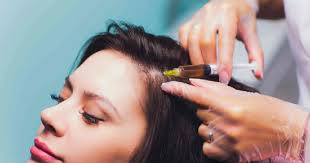 Winter Chemical Peels For Dry Skin