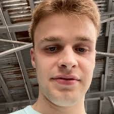 Tom Killeen's Instagram, Twitter & Facebook