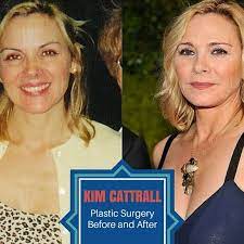 Celebrity Sizes Celebrity Bra Sizes Celebrity Height And Weight Body Measurements Plastic Plastic Surgery Celebrity Plastic Surgery Celebrity Bra Sizes