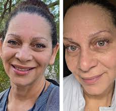 Skin Aesthetics by Carly