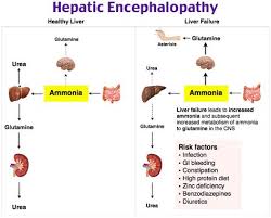 Hepatic Encephalopathy Tip