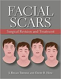 What are scars and how do they form? Facial Scar Revision Surgical Revision And Treatment Thomas J Regan Hom David Amazon De Bucher