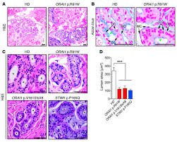Sweat glands synonyms, sweat glands pronunciation, sweat glands translation, english dictionary definition of sweat glands. Jci Store Operated Ca2 Entry Regulates Ca2 Activated Chloride Channels And Eccrine Sweat Gland Function