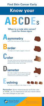 You would think this would be close enough to home to make me vigilant with getting my own skin checked yearly, but it hasn't. How To Detect Skin Cancer Even During Covid 19 Dana Farber