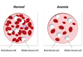 Signs of osteosarcoma in dogs. Anemia Due To Bone Marrow Failure Or Toxicity In Dogs Petmd