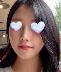 Rhinoplasty in Korea with Dr. Kim Hanjo, Eight Plastic Surgery :  r/SeoulPlasticSurgery