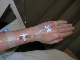 Image result for Peripheral IV Access