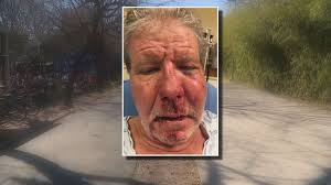 Suspect accused of attacking man