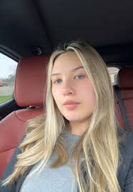 6 Weeks Post-Op: My Rhinoplasty Journey and Experience