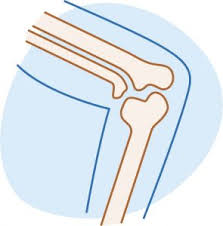 Image result for Continuous Estrogen Replacement