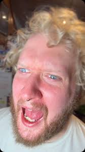 The ring light from hell