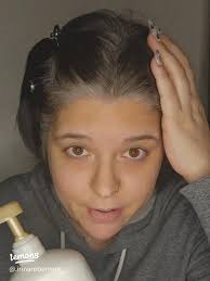 The Ultimate Dandruff Solution: My Top Pick!