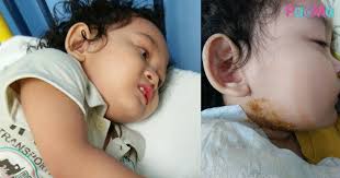 Alkisahnya, semalam kami dijemput ke kenduri aqiqah jiran. Anak Kena Tonsil Sampai Cirit Birit Hampir 2 Minggu Ibu Cuba Petua Buah Tin Legakan Bengkak Tonsil Pa Ma