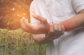 Sol Kol Uyusmasi Neden Olur Nedenleri Nelerdir Kadin8 Com