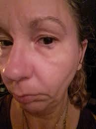 What is the black gunk from eyes in Resident Evil?