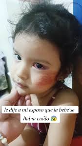 Tirarse Al Agua De Cabeza De Broma