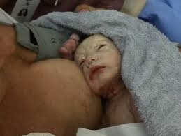 Los síntomas de que el parto es inminente o que ya ha comenzado incluyen: Relato De Parto Normal Com Analgesia Nascimento Do Noah Meu Parto