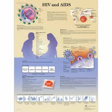 hiv and aids chart