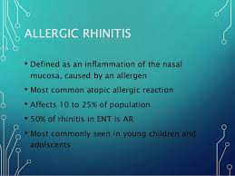 Allergic Rhinitis Presentation