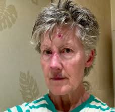 Thank you for all the help I received at last nights Champagne after  falling. I really shouldn't drink the champagne before running!😉 Special  thanks to the runners I delayed especially if they