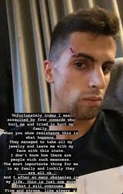 Horrible for Joao Cancelo. Our...