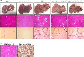 Early Metformin Treatment Improves Liver Disease In Den Injured Rats Download Scientific Diagram