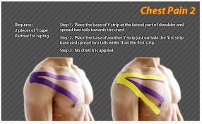 Pin On Kinesiology Tape Ares