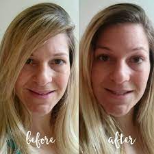 Apply a few drops of the product on your face in the morning and/or evening. Vichy Vichy Liftactiv Serum 10 Supreme 10 Day Results Review Beauty Bulletin Eye Creams Serums