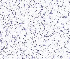 Image result for Rothia