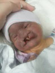Since trisomy 18 and trisomy 13 each have a unique group of characteristics, a physician may be able to determine whether a baby has trisomy 18 or 13 simply by physical examination. Our Angel Allison A Family S Journey With Trisomy 13 Posts Facebook