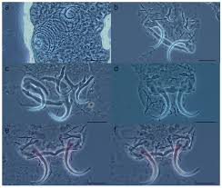 Image result for Dacryotrichia