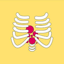 There are many possible symptoms of stomach cancer, but they might be hard to spot. 7 Early Warning Signs And Symptoms Of Stomach Cancer In Women