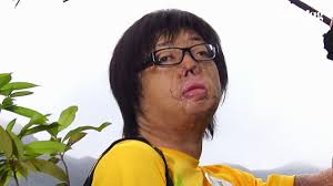 Hong Kong burns survivor travels to Taiwan to support dust party explosion  victims