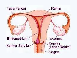 Meski bukan kanker tetapi didalam beberapa kasus, hal ini bisa saja pemicu terjadinya kanker rahim. Mengenal Gejala Kanker Serviks Penyebab Dan Pencegahan