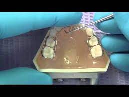 Twin Crib Tc Alf For Pedodontics Removal And Re Placement Youtube Twin Cribs Alf Cribs