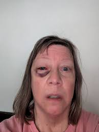 Fundraiser for Diane Sames by Sabrina Marie Sánchez : Support Diane's  Journey to Recovery