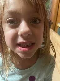 She lost her 1st tooth 💜 I think I'm more excited than she is 🤣