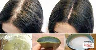 5 causes of hair fall and how to treat it. 7 Home Remedies That Can Help Stop Hair Fall Naturally Blog Health Wau