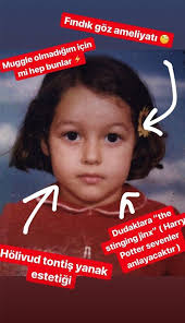 Sorusu karşısından dilan çiçek deniz, bu soru bütün kadın oyuncuların başına bela olmuş bir soru. Dilan Cicek Deniz Yuzumde Hic Estetik Yok Magazin Haberleri Ntv