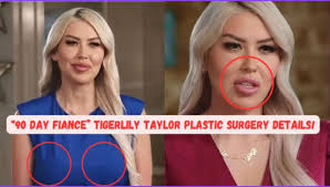 Tigerlily exposes herself for lying about not having had any major plastic  surgery (Full Details in Comments)